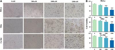 Glucocappasalin Induces G2/M-Phase Arrest, Apoptosis, and Autophagy Pathways by Targeting CDK1 and PLK1 in Cervical Carcinoma Cells